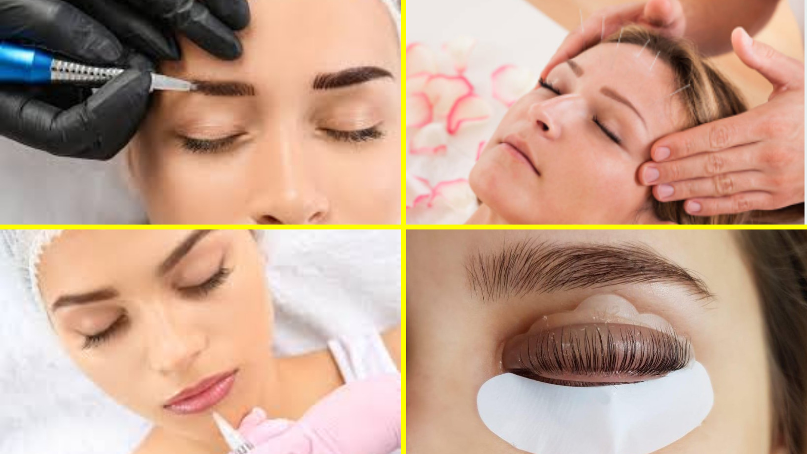 FACIAL ACUPUNTURA ESTETICA GRATIS POR UN AÑO (1)